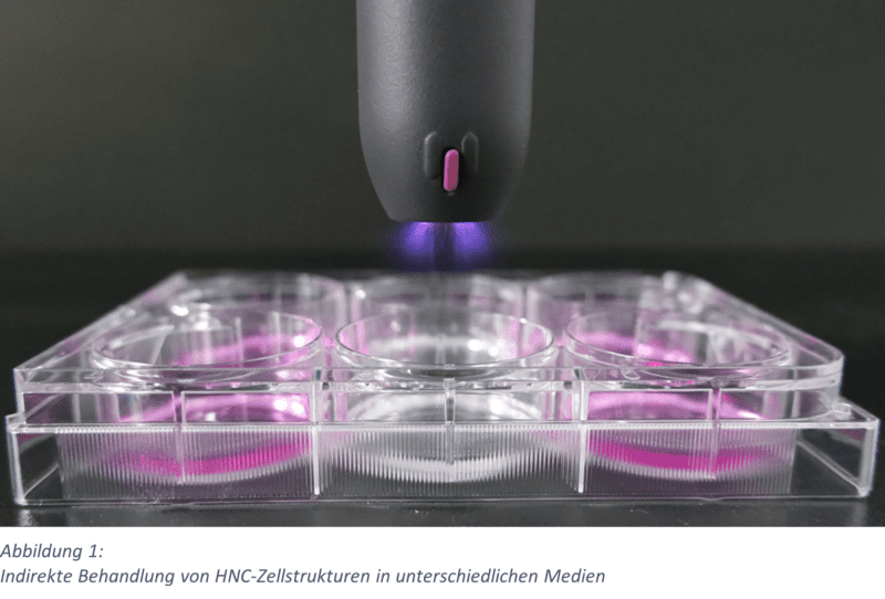 Plasma Als Adjuvante Therapie F R Kopf Hals Karzinome