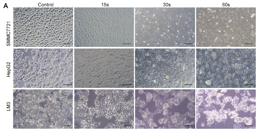 Piezo-CAP inhibits HCC cell proliferation. (A) Optical images of the in SMMC7721, HepG2 and LM3 cellular damage caused by Piezo-CAP treatment at 24 h.